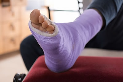Foot Fractures treatment in the Harris County, TX: Willowbrook, Lakewood Forest, Jersey Village, Louetta, Klein, Hedwig Village, Cypress (Bridgeland), Copperfield Place (Park Row), and Northwest Houston areas